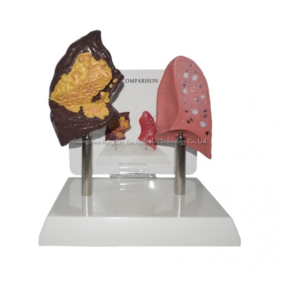 Lung Structure Anatomical Model